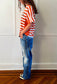 Hysteric Glamour tee
